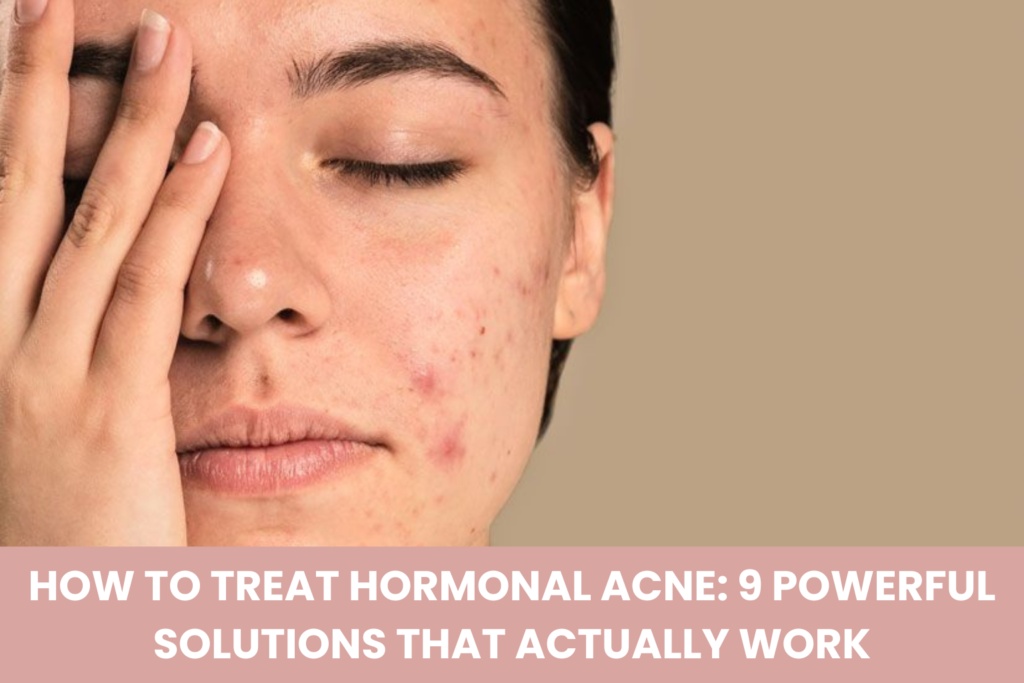 How to Treat Hormonal Acne with skincare products for acne-prone skin