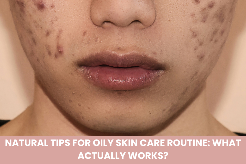 7 acne mistakes that are making your breakouts worse