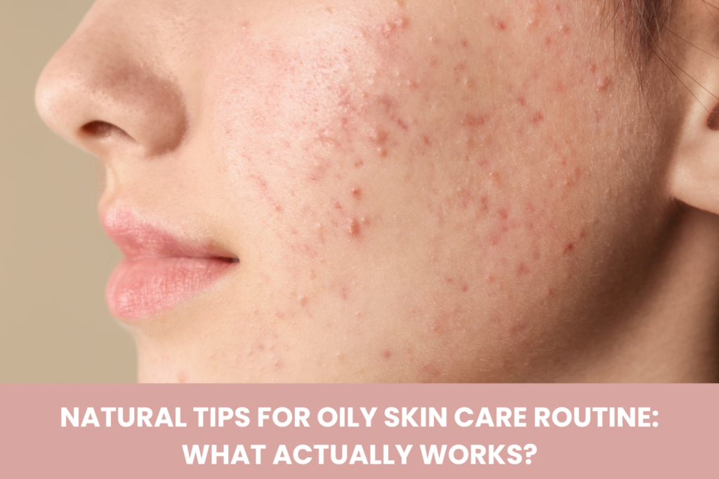 Why Your Acne Keeps Coming Back in the Same Spot