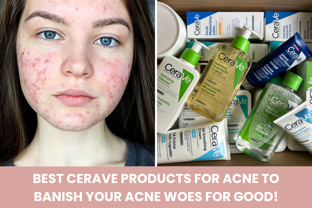 Best CeraVe products for acne and acne-prone skin