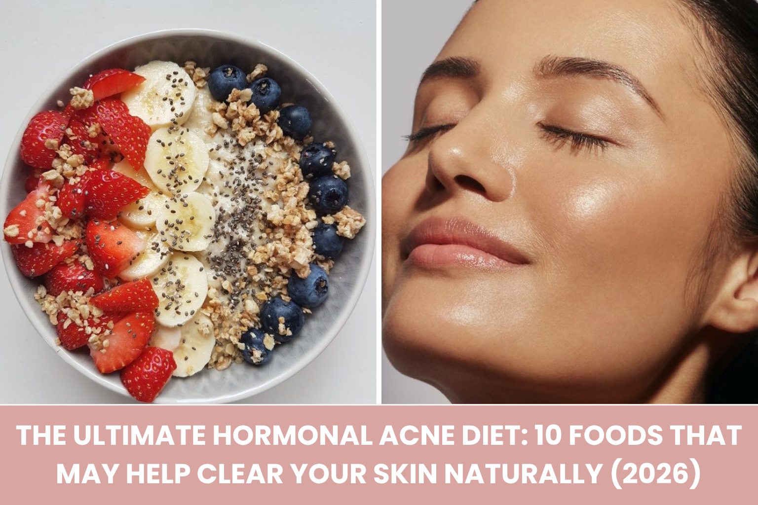 The Ultimate Hormonal Acne Diet: 10 Foods That May Help Clear Your Skin Naturally (2026)